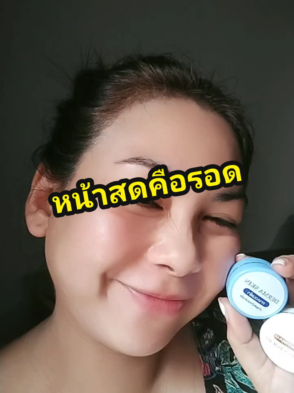 หน้าสด no filter#ผิวใส #หน้าสดก็รอด #คลินิก #ลดฝ้ากระจุดด่างดํา #derma 