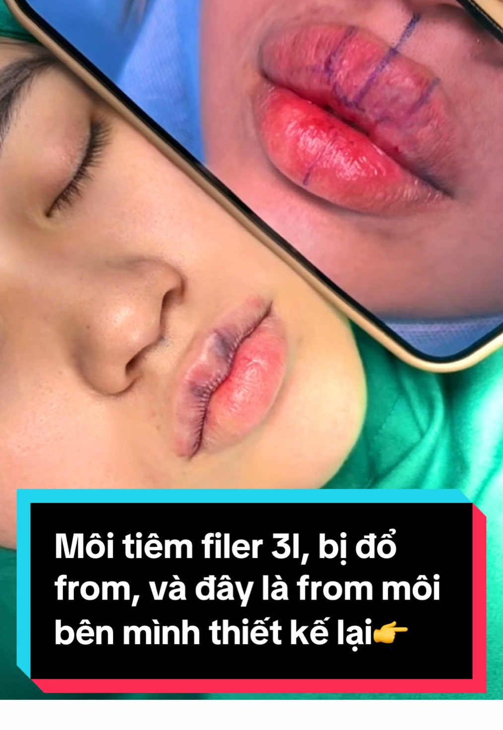 Môi tim xinh thế này ai chịu nổi💋#catmoi #moidep #xh #fyp #viralvideo 