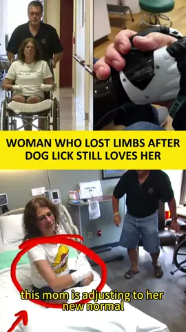 #news #reallife #realstory #dog #lick       is adjusting to her new normal after losing her hands and legs because of a dog lick. Marie Trainer woke up from a 10-day coma to find her limbs had been amputated. After a Caribbean vacation where she scratched herself, she came home , where her dog, Taylor, greeted her with lots of kisses, running her tongue over the little wound. Four days later, Trainer became was rushed to the hospital with a severe infection and septic shock, her arms turning black. Despite losing her limbs to a dog lick, she said she'll never stop loving Taylor.
