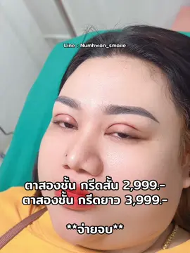 #เซลล์น้ำหวาน  #ตาสองชั้น #ฮายอน  #ตาสองชั้นกรีดยาว  #ตาสองชั้นหวานๆ 
