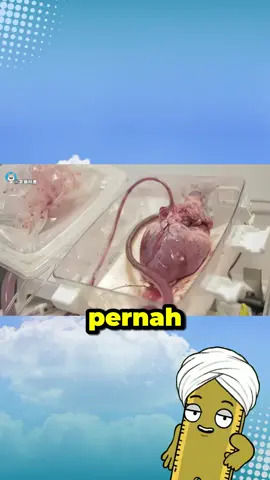Pernah kepikiran nggak, kenapa jantung kita bisa terus berdetak tanpa henti? Ternyata, jantung punya mekanisme yang super canggih, lho! Organ seberat kurang dari 300 gram ini adalah mesin abadi yang bekerja dari kita masih di dalam kandungan sampai akhir hayat. Yuk, kita kupas tuntas rahasia di baliknya dan kenapa kita harus lebih menghargai 
