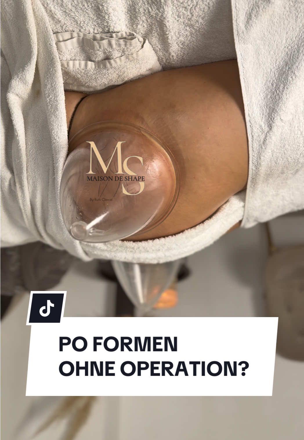#povergrösserung #ohneop #formen