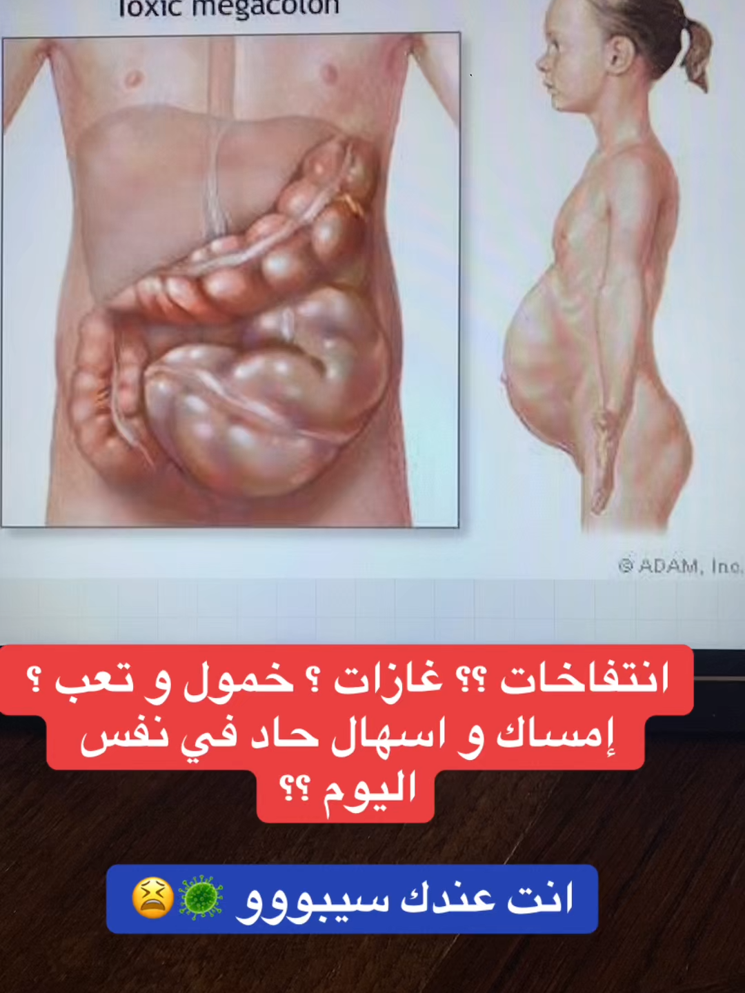 #قولون_هضمي #توعية_صحية #السعودية_الكويت #إنتفاخ_البطن #مكة_المكرمة_السعودية #الرياض_الان #الرياض_الآن🇸🇦🇸🇦 #قولون_تقرحي #إنتفاخ_القولون #إنتفاخ_البطن_والأمعاء #إمساك #قولون #الدمام #إمساك_مزمن #قولون_معدة_غازات_إنتفاخات_إمساك_حموضة #الرياض_جده_مكه_الدمام_المدينه