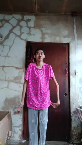 YES I HAVE SEVERE SCOLIOSIS BUT I CAN DANCE 💃  #viraltiktok #fyppppppppppppppppppppppp #scoliosischeck #fyp 