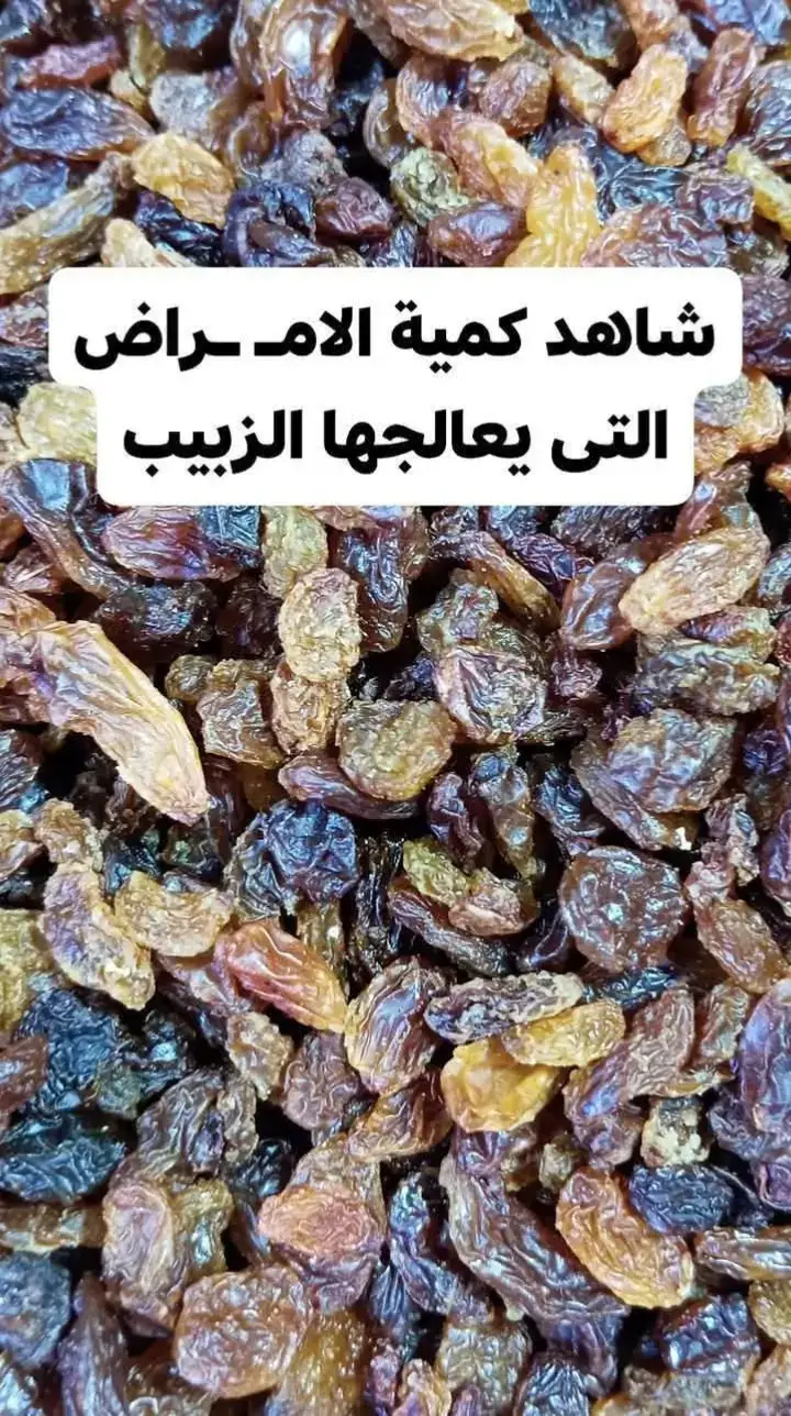 الزبيب : يغلى 10 حبات فى ماء كما يغلى الشاى ويصفى ويشرب فى اى وقت وأى زمان كوباية منه كل يوم مفيدة خاصة للمدخنين والذين يعانون من البلغم وكذلك مفيد للمعده - - هو فى كل بيت وسهل التحضير . شاهد كمية الامـ ـراض التى يعالجها الزبيب وماذا يفعل فى جسم الانسان الزبيب هذا الذى يطلق عليه فى مصر هذا الاسم الزبيب له فوائد رهيبة لجسم الانسان يغفل عنها الكثير الزبيب هو العنب المجفف ومنه الاسود والاصفر ومنه المحتوي على البذور وآخر بدون بذور ، ويتميز الزبيب بخواص العنب الطازج ، _ويحتوى الزبيب على البوتاسيوم والفوسفور والكالسيوم والماغنسيوم والنحاس والحديد والالياف والمواد الكربوهيدراتية وفيتامين ب ، ج ، والسكريات ، وهو غني بالمواد المضادة للاكسدة_ وله دور كبير فى علاج امراض الجهاز التنفسى وامراض الجهاز الهضمى. *بعض فوائد الزبيب .. الفوائد الطبية 🍇1- مخفض لضغط الد م المرتفع 🍇2- مخفض للكوليسترول فى الد م 🍇3- واقى من أمراض سرطان القلب 🍇4- ملطف للسعال بشرب مغلى الزبيب فى الماء 🍇5- طارد للبلغم 🍇6- مقاوم للميكر وبات والفير وسات 🍇7- مضاد للأكسدة 🍇8- مانع لتكون طبقة البلاك على الاسنان 🍇9- مخلص للجسم من السـ موم 🍇10- مقوي للطحال والكبد والمعدة 🍇11- مقوي للذاكرة 🍇12- واقي من سرطان القولون 🍇13- واقي للعيون من الأمراض 🍇14- واقي من هشاشة العظام 🍇15- مضاد للالتهابات 🍇16- ملين 🍇17- منقي للد م 🍇18- مصفى ومنقي للصوت _الامراض التى يعالجها الزبيب_ 🍇1- الامساك. 🍇2- البوا سير. 🍇3- تسوس الاسنان. 🍇4- التهاب اللثة. 🍇5- الروماتيزم. والتهاب المفاصل. 🍇6- امراض الكبد والمرارة. 🍇7- سوء التغذية ونقص الوز ن. 🍇8- التهاب الحلق. 🍇9- أمراض الرئة والصدر. 🍇10- امراض الكلى والمثانة وحصى المثانة 🍇11- تقطير البو ل. 🍇12- الملاريا. 🍇13- داء النقرس. 🍇14- الشقيقة. 🍇15- اليرقان. 🍇16- فقر الد م. 🍇17- أمراض المعدة 🍇18-حموضة المعدة 🍇20-النزلات المعوية 🍇21- الهـ رش والحكة 🍇22- الجدري  لا تنس الصلاة على النبي 💜💜💜 #نصائح_صحية  #صحة_طبيعية  #معلومات_مفيدة  #وصفات_مجربة  #أعشاب_طبيعية 