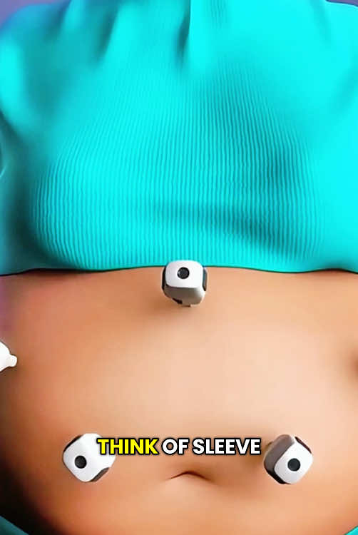 Sleeve Gastrectomy Surgery (3D Animation) #gastrectomy #sleevegastrectomy #gastrectomysleeve #gastrectomysurgery #weightloss #stomachsurgey #sleevegastrectomie #medical3danimation #3dmedicalanimation