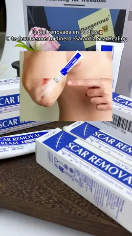 #scar #SelfCare #tiktokshopsummerturnup #fypシ #skincare#burnscarsr 