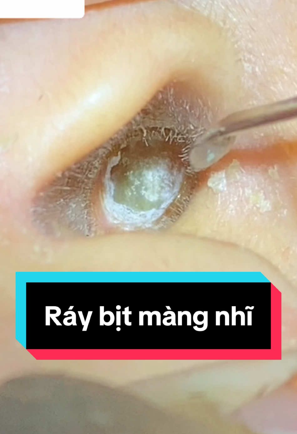 Trả lời @Sâu Ăn Lá dùng bộ riêng thì sẽ an tâm bác nhé#raytai #xuhuong #tronghoanbarbershop 