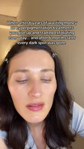 #hyperpigmentation #darkspots #skincare 