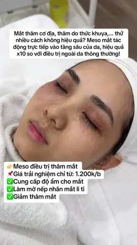 Meso điều trị thâm mắt #LearnOnTikTok #viralvideo #trending #lamdepkhongkho #mesotherapy 