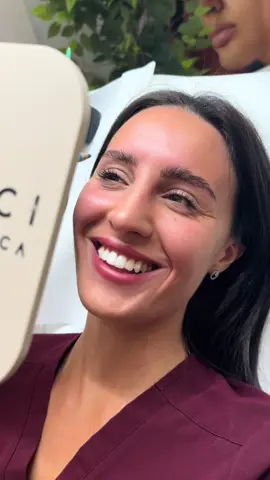 ✨BOTOX COME PREVENZIONE ED EFFETTO LIFTANTE✨ Sempre più giovani scelgono il botox  non per cambiare i tratti, ma per prevenire la formazione delle rughe, aiutando a mantenere la pelle più liscia, più a lungo.  @Sarah Esposito  #medicinaestetica #botox #passion #rughe #aestheticmedicine 