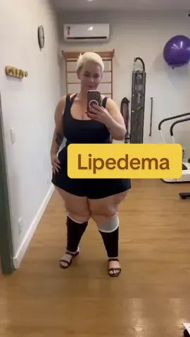 Meu corpo carrega histórias que o lipedema não define — eu sou muito mais do que um diagnóstico. Você pode se amar, cuidar e se achar linda, mesmo tendo uma doença sem cura. ❤️🤗 #lipedema #lipedemafighter #lipedemagirl #lipedemalegs #lipedemalife 