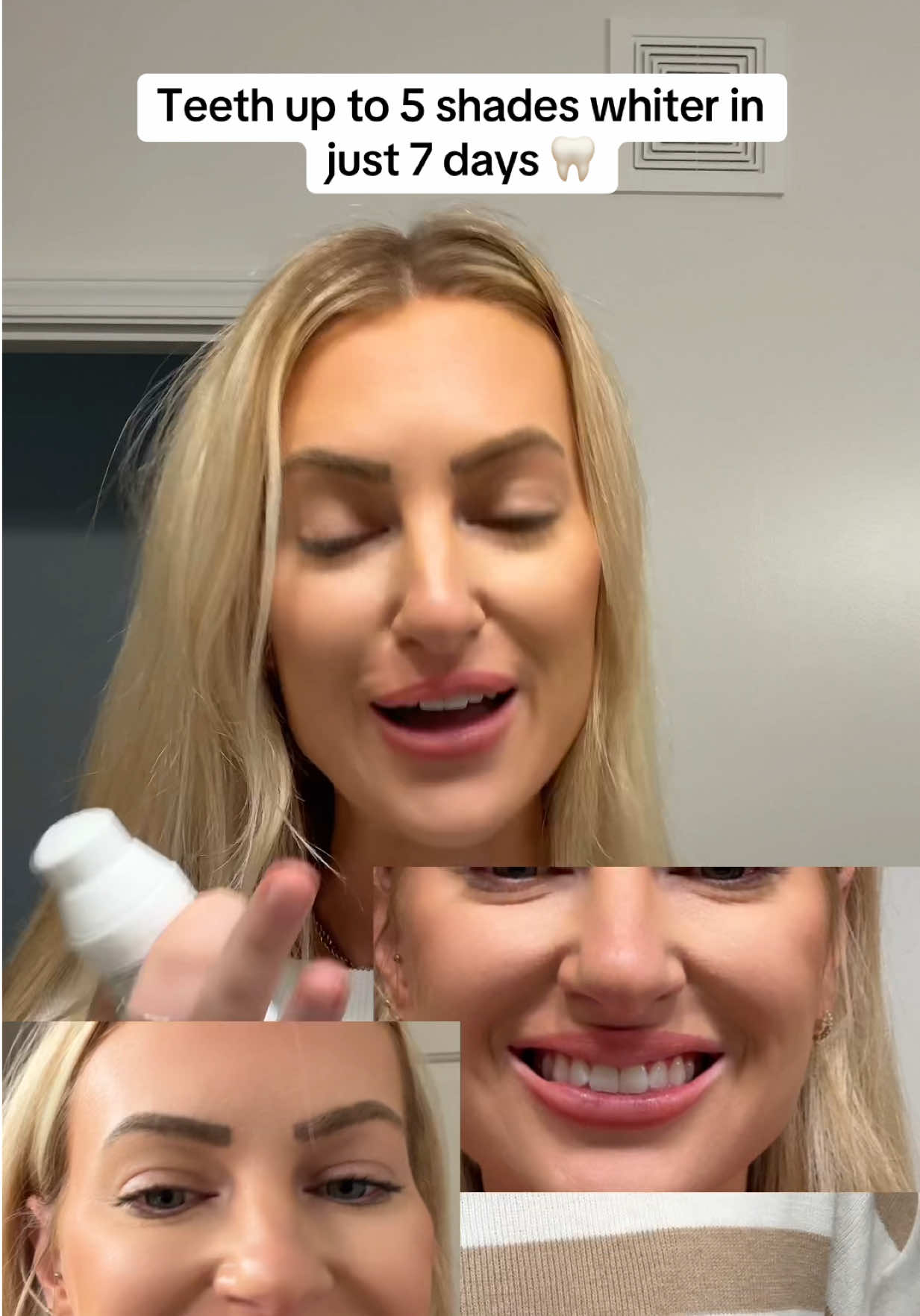 @Smileactives teeth up to 5 shades whiter in just 7 days 🦷  #tiktokshopcreatorpicks #smileactives #teethwhitening #whiteteeth #prowhiteninggel 
