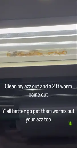 Worms living inside of your body for years and you don’t even know it 😳😳😳 #fyppppppppppppppppppppppp #health #body #tapeworms 