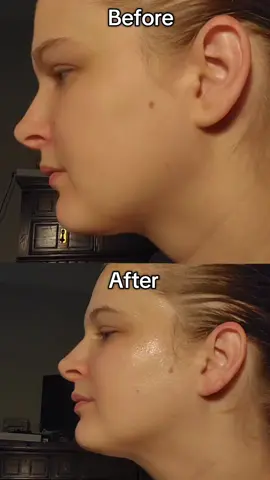 NAD+ Powered Face Lift! #numbuzin #nadliftmask #NAD #liftingmask #kbeauty @numbuzin Global Marketing 