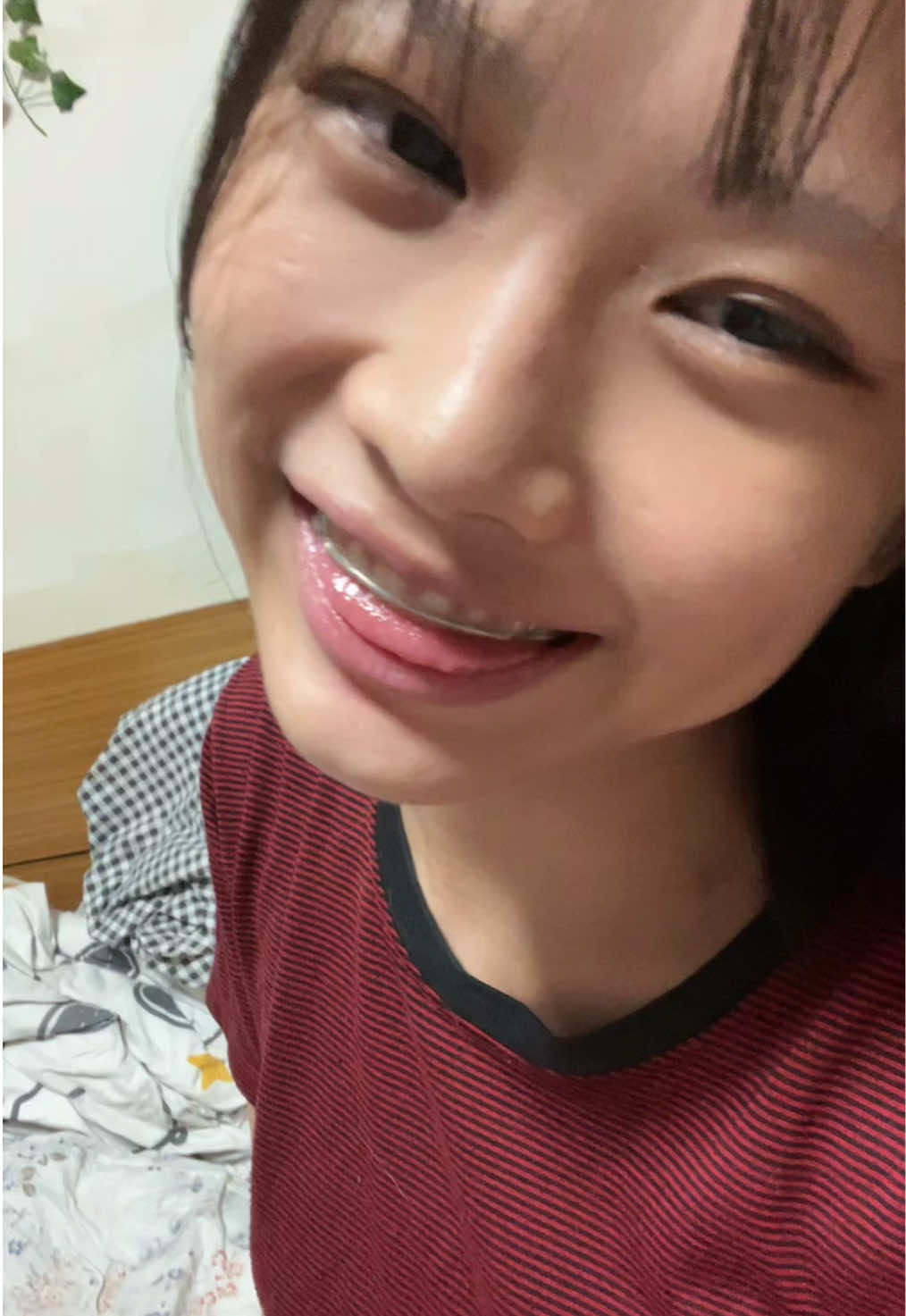 ไม่ฟันเหล็ก มีแต่ฟันรี