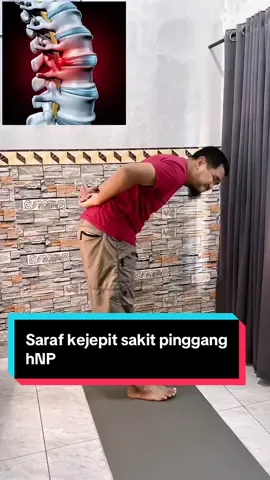 Saraf kejepit yang diakibatkan HnP #sarafkejepit #sakitpinggang #nyeripinggang #fyp 