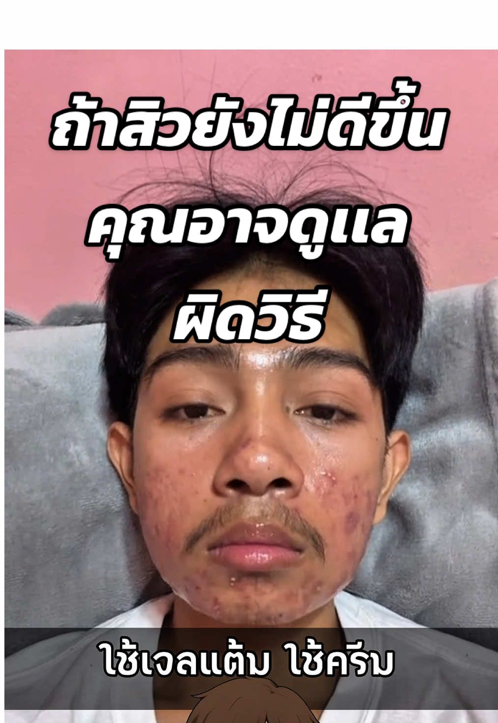 สิวมึงไม่หายสักที เพราะพลาดตรงนี้!🔥 #สาระความรู้ #เรื่องเล่า #ซิงค์ลดสิว #เมดิต้าซิงค์พลัส #ฟีดดดシ 
