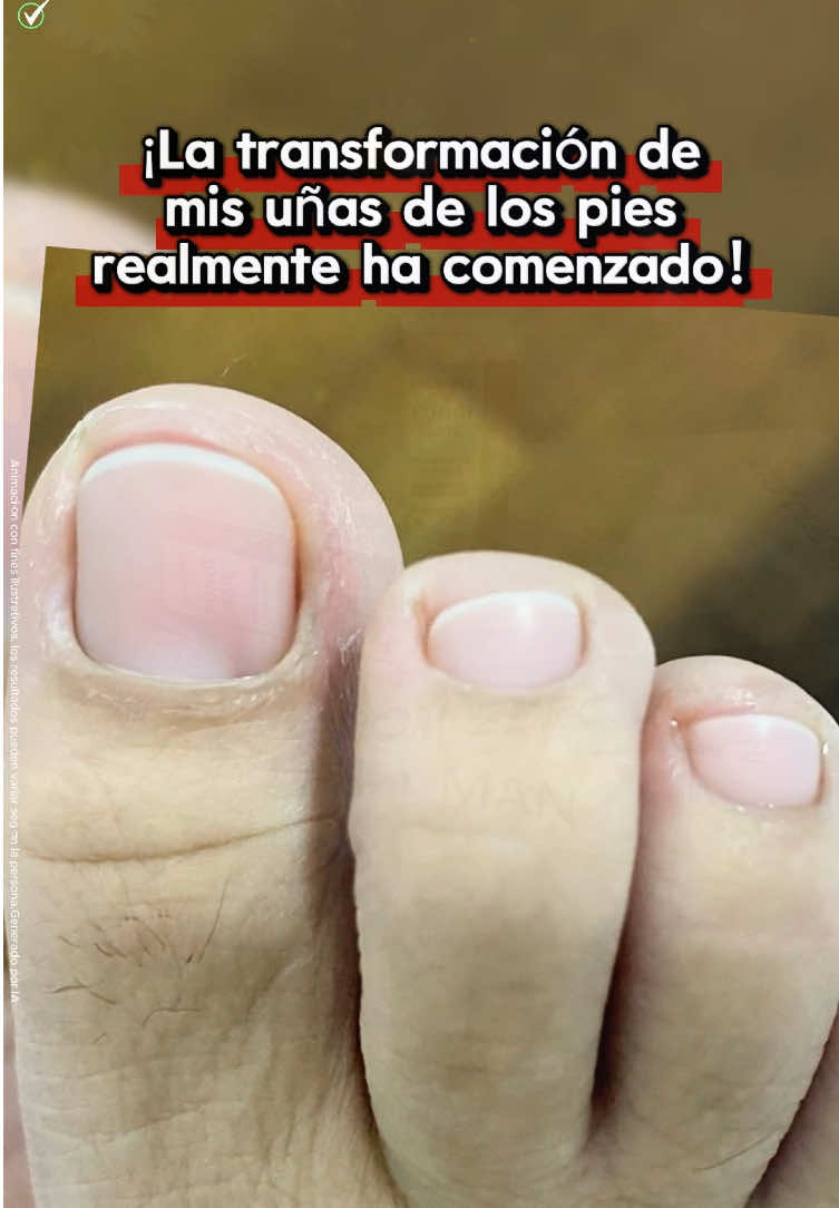 ¡Lo bueno que es, solo lo sabe quien lo prueba! ¡Mis pies son la mejor prueba!#nailcare #toenails #nails #gainknowledge #tiktokmademebuyit 