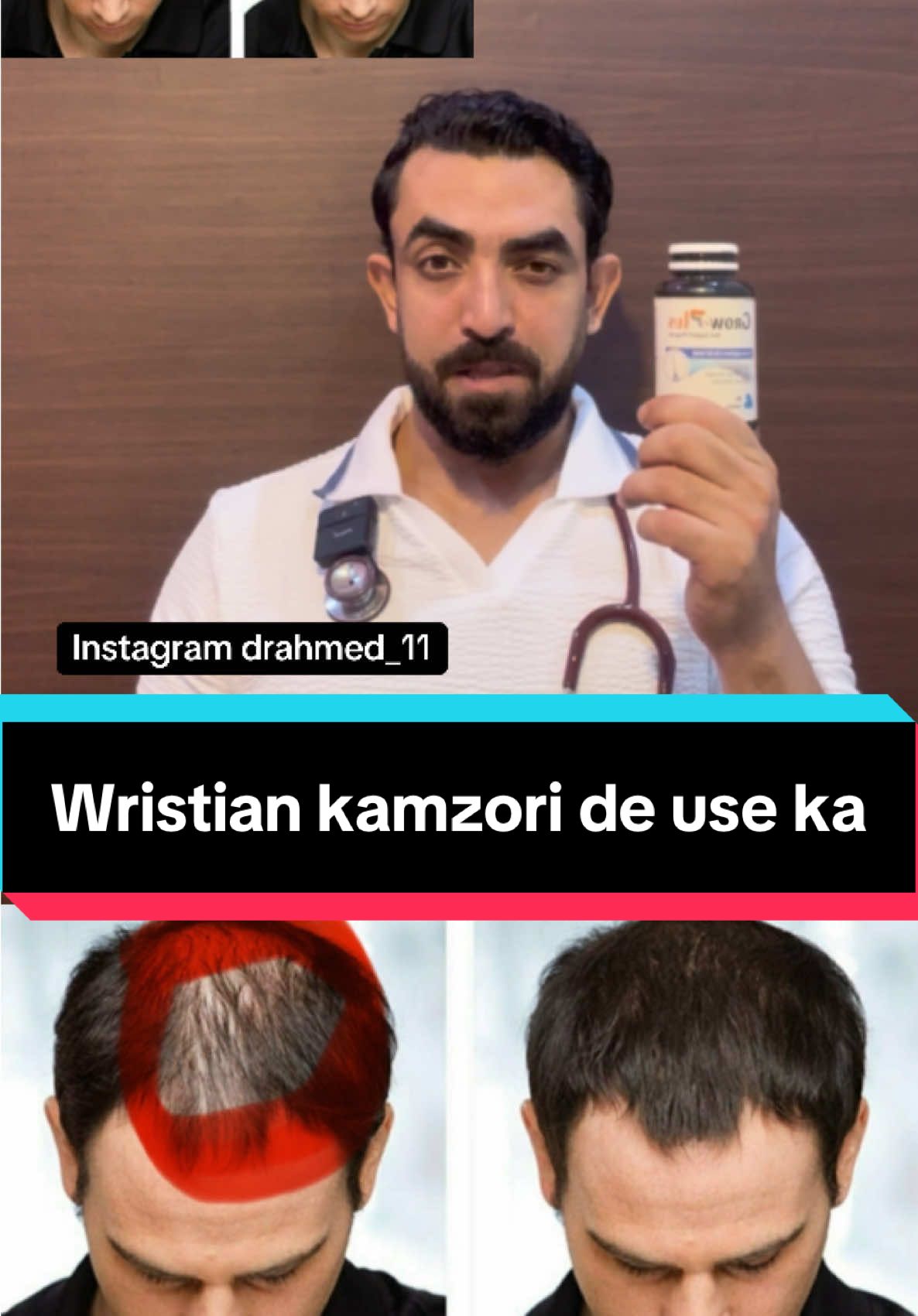 @Dr ahmed khan #drahmedkhan #foryou #tiktok #viral #tiktok 