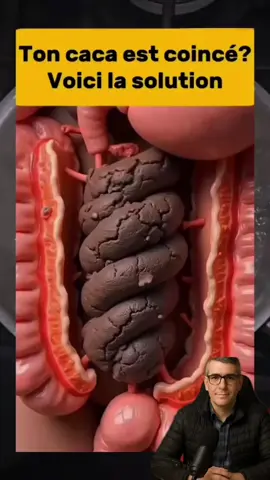 للتخلص من البرواز بطريقة سهلة#fyp #explore #recette #trend 