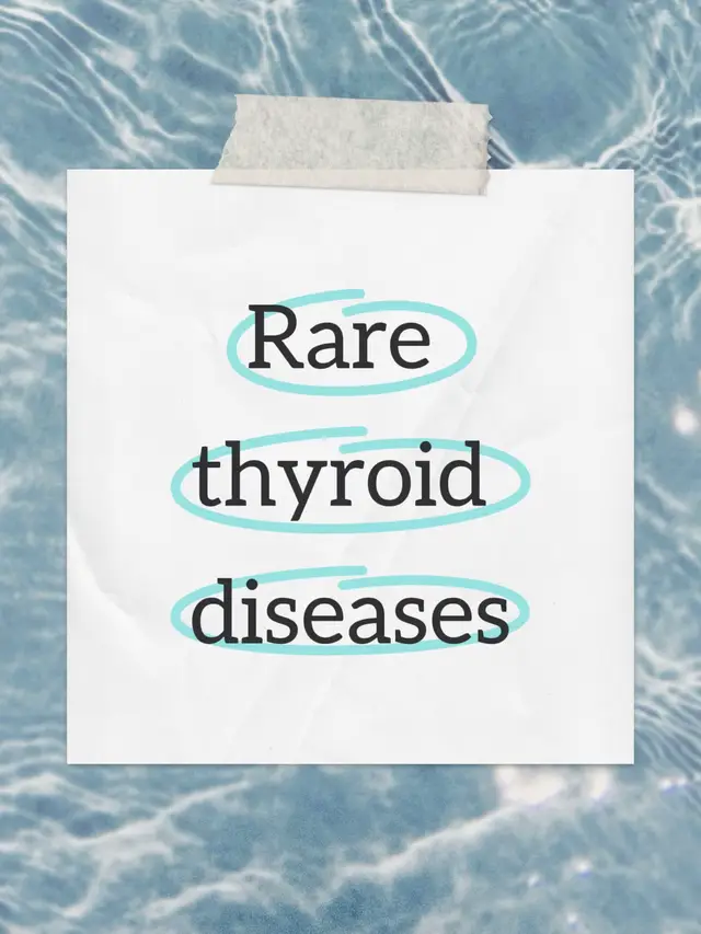 Structural or Developmental Conditions Thyroid hemiagenesis – one thyroid lobe never develops (congenital). Lingual thyroid – thyroid tissue located at the base of the tongue instead of the neck. Ectopic thyroid – thyroid tissue develops in unusual places (mediastinum, esophagus, etc.). Rare Functional Disorders Resistance to Thyroid Hormone (RTH) – genetic condition where the body’s tissues don’t respond properly to thyroid hormones. TSH-secreting pituitary adenoma (TSHoma) – a very rare pituitary tumor that causes hyperthyroidism by producing excess TSH. Familial dysalbuminemic hyperthyroxinemia (FDH) – benign inherited condition with abnormal thyroid test results due to unusual binding proteins. Rare Autoimmune/Inflammatory Thyroid Diseases Riedel’s thyroiditis – extremely rare, chronic inflammation that turns the thyroid into hard, fibrous tissue. IgG4-related thyroid disease – part of the IgG4-related systemic disease spectrum, can mimic Hashimoto’s or Riedel’s. Thyroid sarcoidosis – granulomatous inflammation in the thyroid (part of systemic sarcoidosis). Pendred syndrome – inherited disorder causing hearing loss and thyroid goiter. McCune-Albright syndrome – genetic mutation leading to hyperthyroidism among others.  Subacute Granulomatous Thyroiditis (de Quervain’s) Rarity: Less common than Hashimoto’s, often after viral infections. Symptoms: Painful thyroid, fever, transient hyperthyroidism, then possible hypothyroidism. Treatment: NSAIDs or steroids for pain/inflammation.