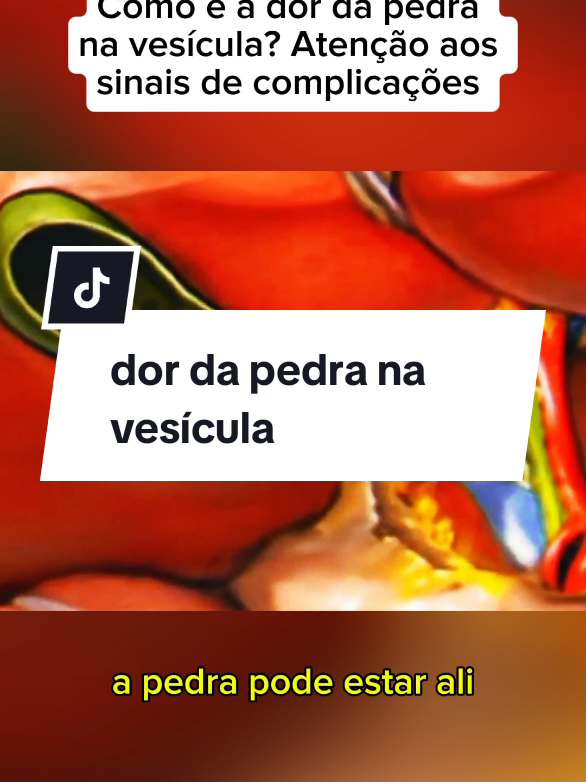 como é a dor da pedra na vesícula #sintomas #pedranavesicula #vesicula #vesiculabiliar#calculobiliar 