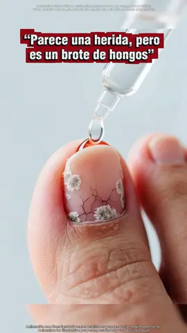 ¿ Cómo no voy a limpiarme los pies? Solo hice un paso.#nailcare #tiktokmademebuyit #toenails #tiktokshop #gainknowledge 