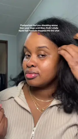 Idk what was worse this or no edges but Mary Ruth’s didn’t come to play with this one #maryruthsorganics #maryruths #tiktokshopfalldealsforyou #hairvitamins #postpartumshedding 