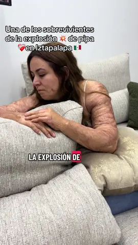 Fue un milagro gracias Dios por esta oportunidad #iztapalapa #dios #viral  #accidente #gas