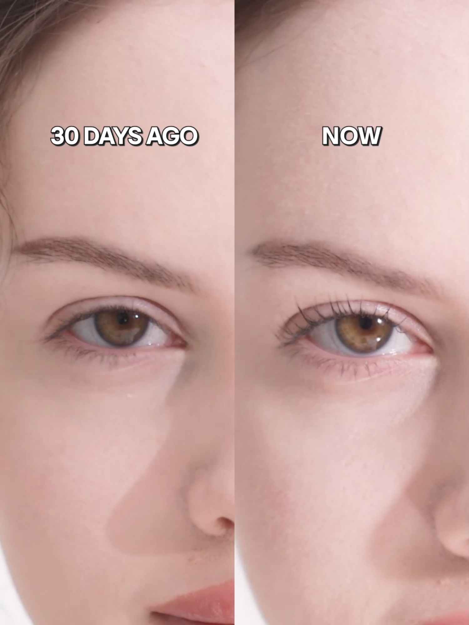 👀 The 30-day difference with our Honest Eyelash Serum? Absolutely striking! ✨ #Benton #HonestEyelashSerum #KBeauty #LashCare #LashSerumResults #Lashes