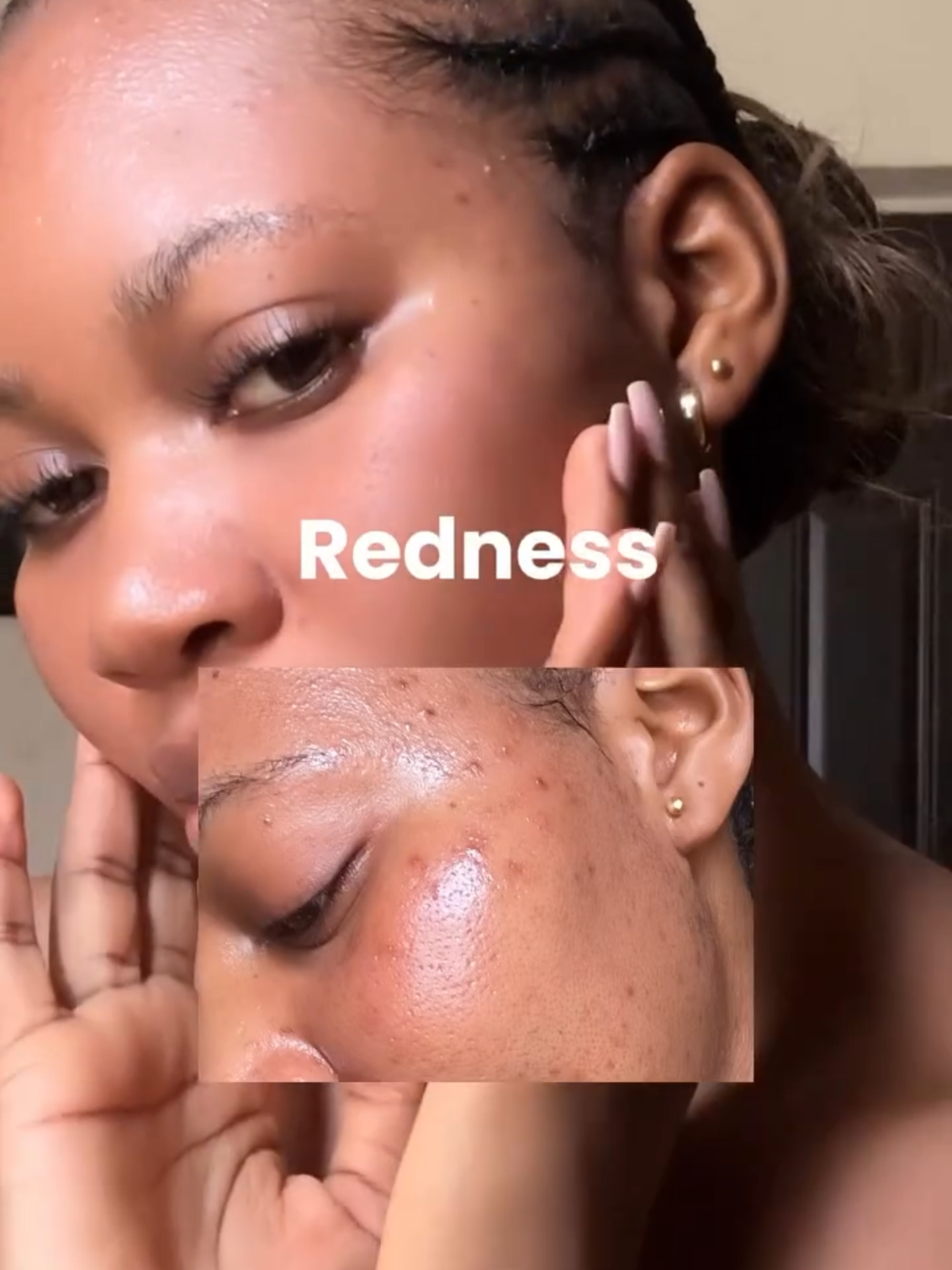 Restore & strengthen your skin barrier! 💙 The EGF Skin Barrier Cream Toner soothes, hydrates, and repairs for 4.8x faster recovery leaving the skin plump, healthy, and youthful. Thank you for your honest review on IG @iambeccadam 💝 #zipiderm #EGFSkinBarrierCreamToner #EGF #CelltrionBioEGF #EGFskincare #skincare #kskincare #kbeauty #koreanskincare #acneskin #dryskin #koreanskincare #celltrionskincure #glassskin #skincarehacks #skincaretip