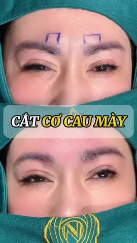 CẮT CƠ CAU MÀY là gì⁉️ Kim ##Nganpham#Catcocaumay  #TrungHoa   #Douyin #fyp     