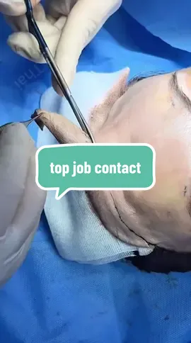 top job contact#drthongthaichuyensuamui #PTTM #xuhuongtiktokkk #drthongthai #drthongthaicangdamat 