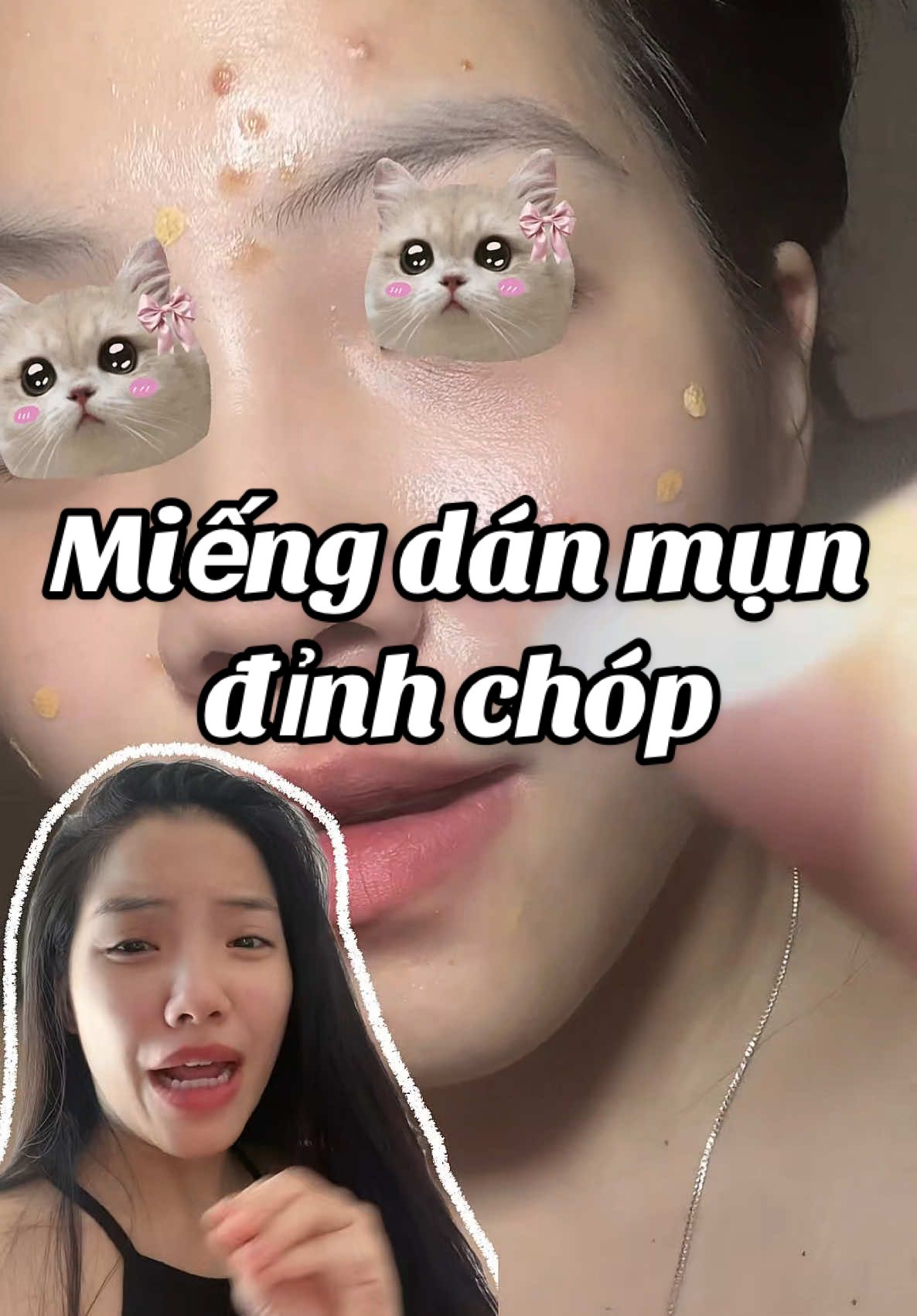 Trả lời @huyenle 349 chuẩn luôn bà ạ, dán nhiều lần bằng miếng dán ban đêm nó gom dần rồi hút ra, chứ ko phải dán 1 lần là hút luôn đc. Miếng dán mụn chơ có phải miếng dán thần kỳ đâu bà 😂 #jessicareview #focalskin #miengdanmun 