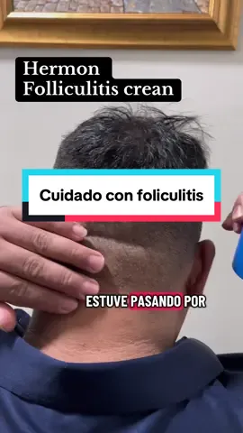 Folliculitis tratamiento Hermon #folliculitis #tratamiento #hermon #hair 