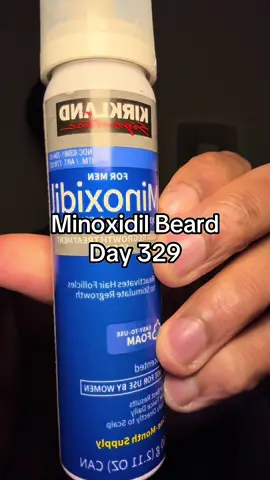 Minoxidil Beard Day 329 #fyp #viral #foryourpage #minoxidilbeard #minoxidil 