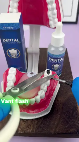 #tiktikmademebuyit #hydroxyapatite #badbreath #cavity #yellowteeth 