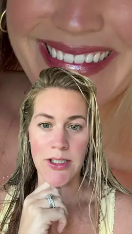 Let’s talk about this lip flip y’all…. Game changer 😍 #lipflip #botox #gummysmile 