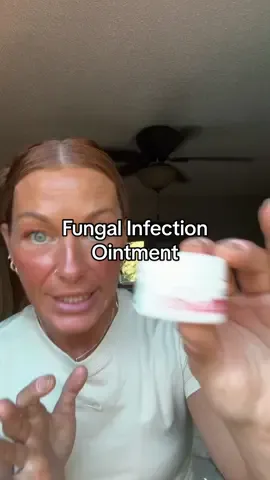 Replying to @mamadaughterduo2 I still an shocked at how this ointment cured my finger fungus!! @EMUAID #emuaid #fungalinfection #toefungus #manicure #tiktokshopblackfriday 