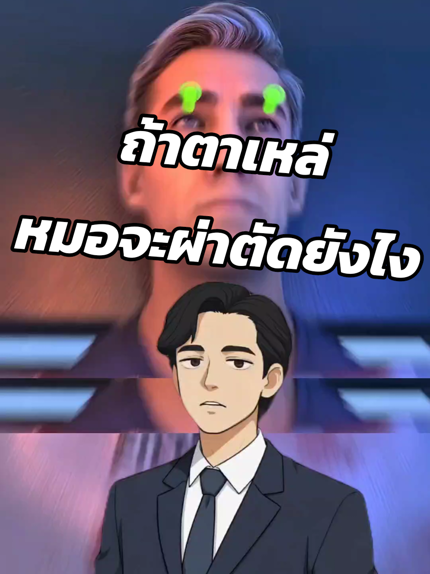 หมอผ่าตัดตาเขยังไง ? #เล่าเรื่อง #ฟีดดดシ #fyp #ความรู้รอบตัว #สาระน่ารู้  Cr Zack D Filmz 