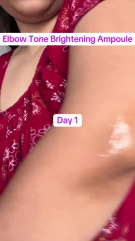 Elbow tone brightening ampoule @SKIN1004 US @skin1004_influencers #GoViralWithSKIN1004Challenge #SKIN1004White #skin1004 #centella #TikTokMadeMeBuyIt  