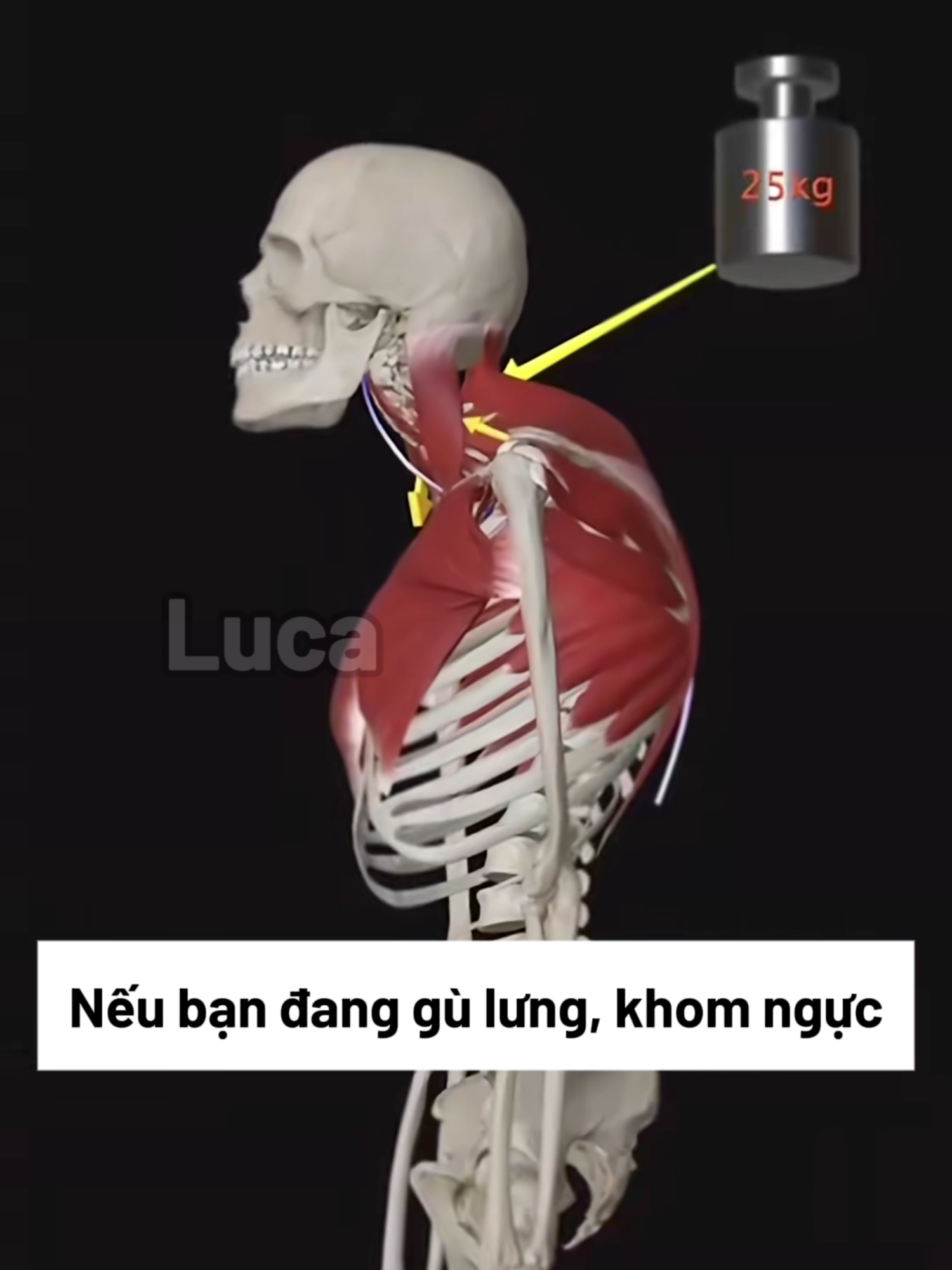 HẾT GÙ LƯNG DÁNG ĐẸP CHỈ VỚI 1 ĐỘNG TÁC #Luca #xuhuong #virals #baitap #gulung
