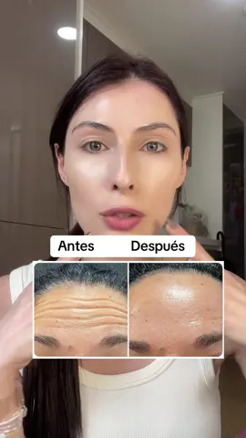 Elimina arrugas o líneas de expresión fácil con serum coreano 