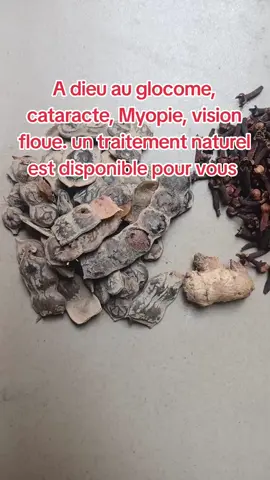 ##tiktokfrance🇨🇵 #tiktoksenegal🇸🇳 #tiktokamerika🇺🇸 #visibilités 