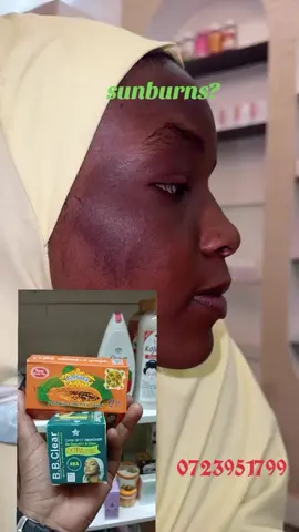 #sunburns #bbclear #papayasoap #beautycollectionC6 #fyp