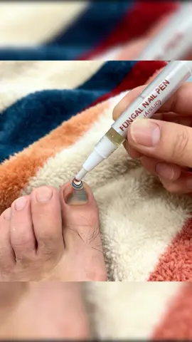#nailfungus #yellownails #nailcare #nailtok #nailfungus 