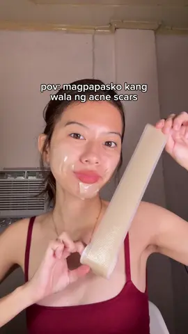 healing na w/ silicone scar sheets #fyp #siliconescarsheets #scars #acnescar #keloid 