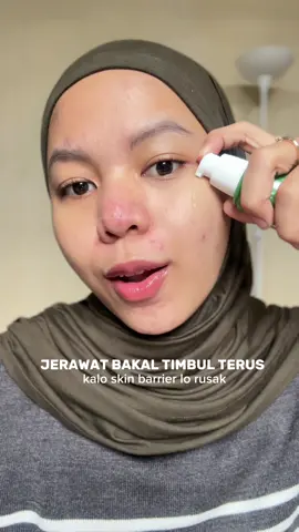 in love with 2% BHA Fight Acne Pro Serum YOU iniii omg super workss di aku yg acne prone skin👀🫰🏻 #serum #acneserum #acneskin #skincare 