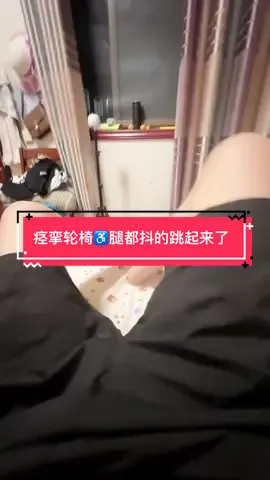 #截瘫 #diaper #diaperchange #失禁 #痉挛 痉挛性截瘫，控制不住的抖动。